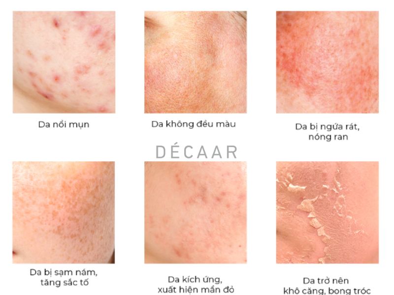 sau peel da bao lâu thì tẩy da chết